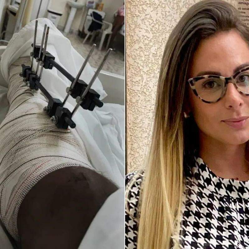 Ciclista foi atropelado pela ex-primeira-dama de Bertioga, Vanessa Matheus, em dezembro do ano passado