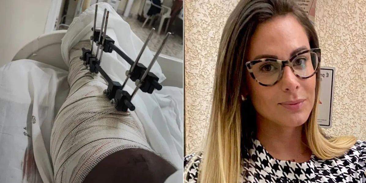 Ciclista foi atropelado pela ex-primeira-dama de Bertioga, Vanessa Matheus, em dezembro do ano passado