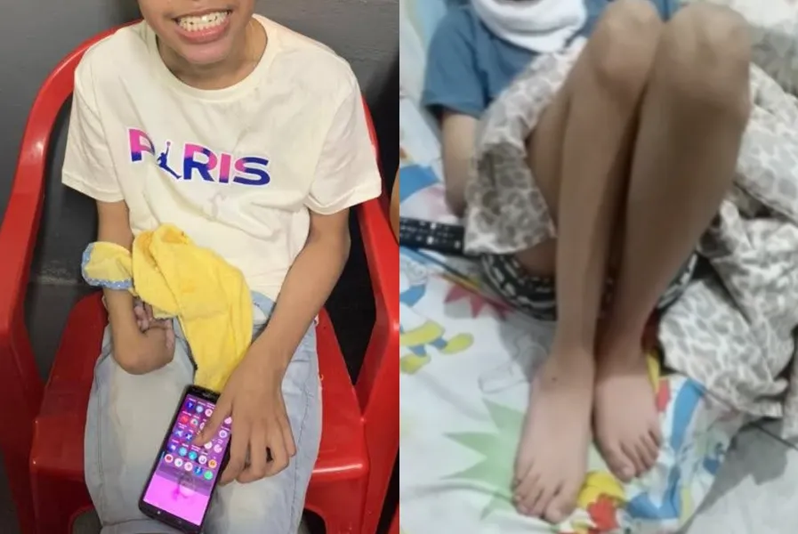 O menino de 15 anos aguarda por cirurgia para voltar a andar