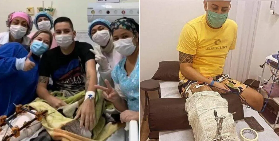     Durante os mais de 100 dias internado, o jovem pegou uma bactéria na perna    