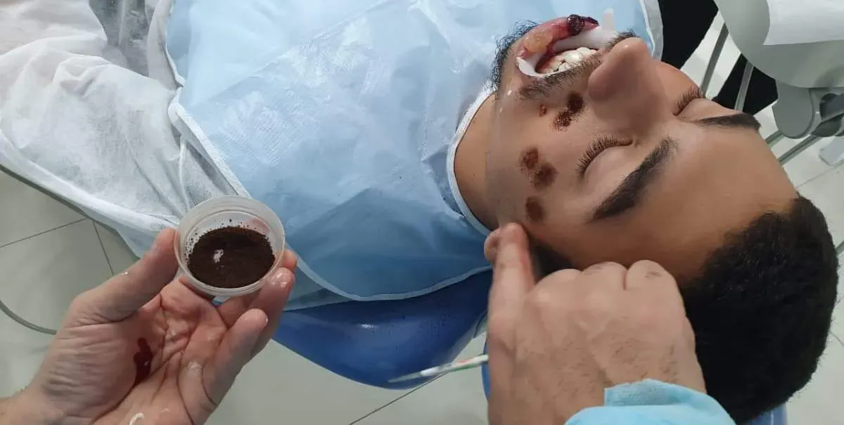  Doenças estudadas pela Odontologia são simuladas através de maquiagem 