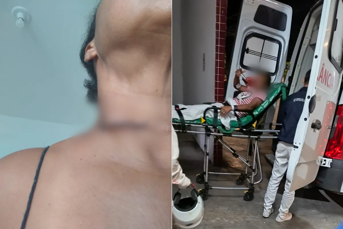 A mulher teve um corte no pescoço e teve que ser internada no Hospital Santo Amaro