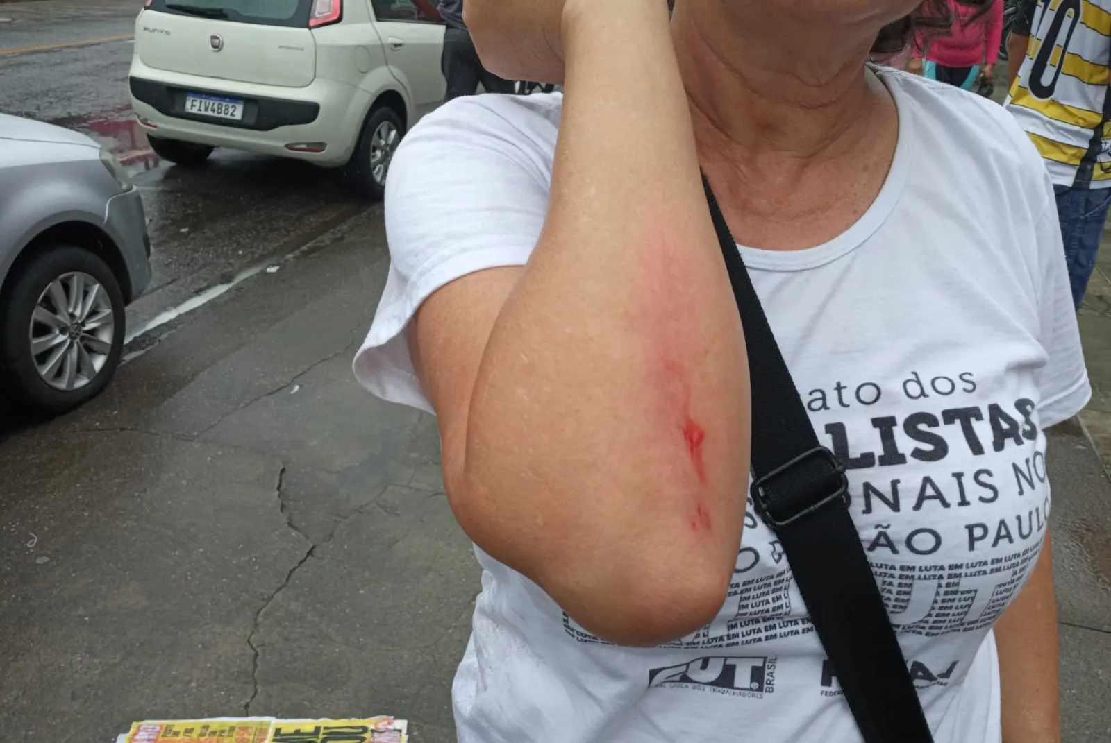 Solange mostra o braço machucado depois da agressão sofrida em Santos