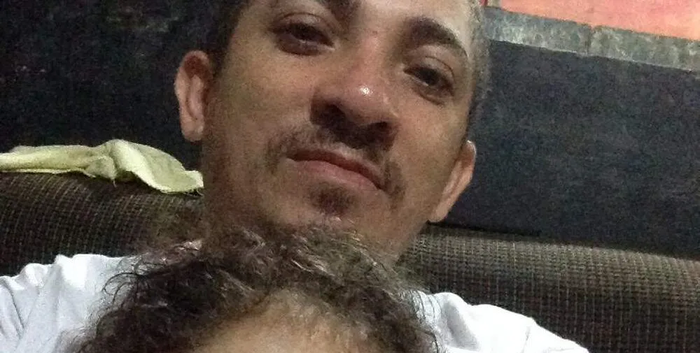  Pai e filha de Guarujá sofrem com a doença dos ossos 