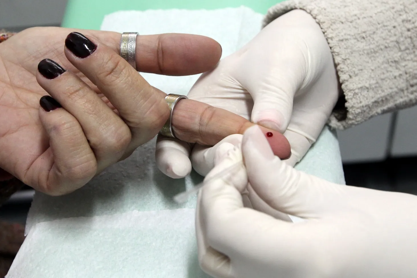 Os testes para detecção do HIV são importantes para o tratamento da doença, quando confirmados