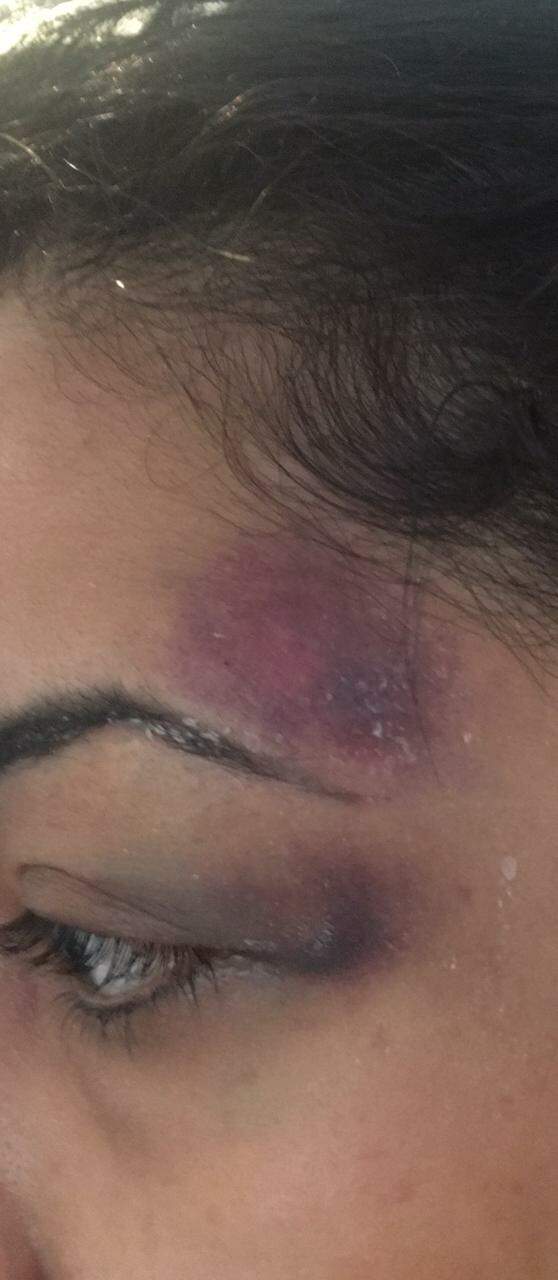 Mulher afirma ter sido agredida por 12 policiais militares