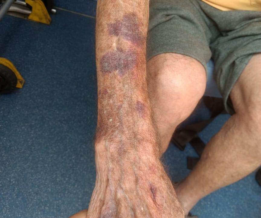 Idoso de 91 anos teve ferimentos após ser agredido por assaltantes, em São Vicente 