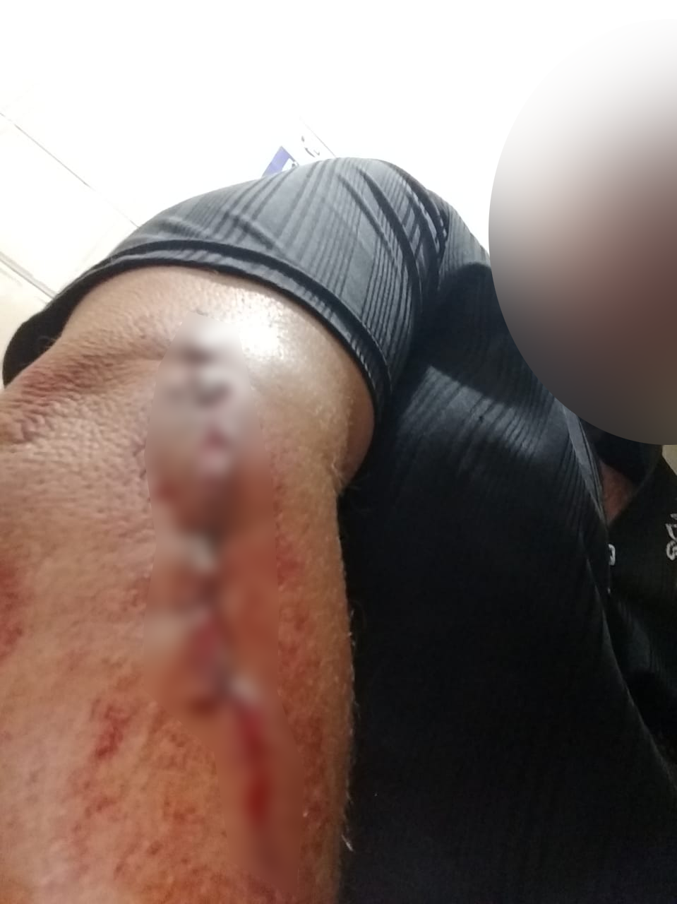 Subtenente teve braço baleado durante crime, na terça-feira (25) 