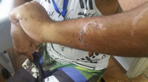 Vítima ficou com ferimentos no braço após tentativa de latrocínio no ano passado, em Praia Grande