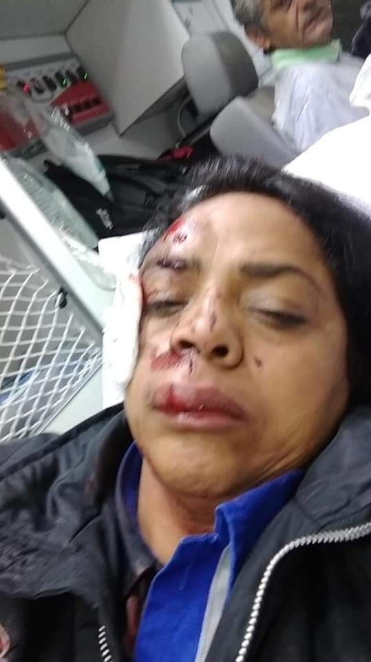 Ao ser derrubada da bicicleta por bandidos, vítima teve diversos ferimentos no rosto