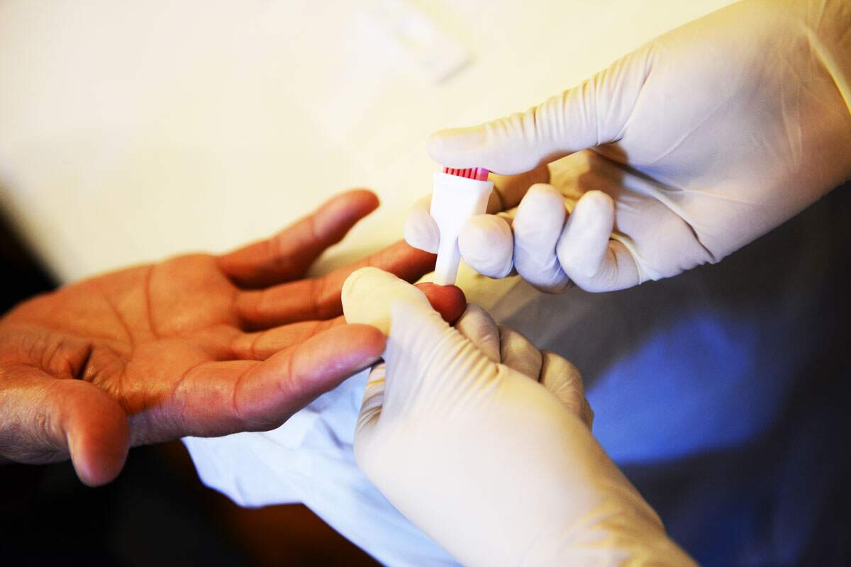 Recomenda-se a realização do teste para hepatite C pelo menos uma vez na vida