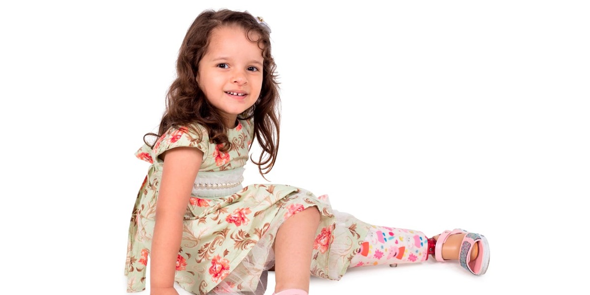Prótese ortopédica deve ser trocada anualmente conforme crescimento da criança