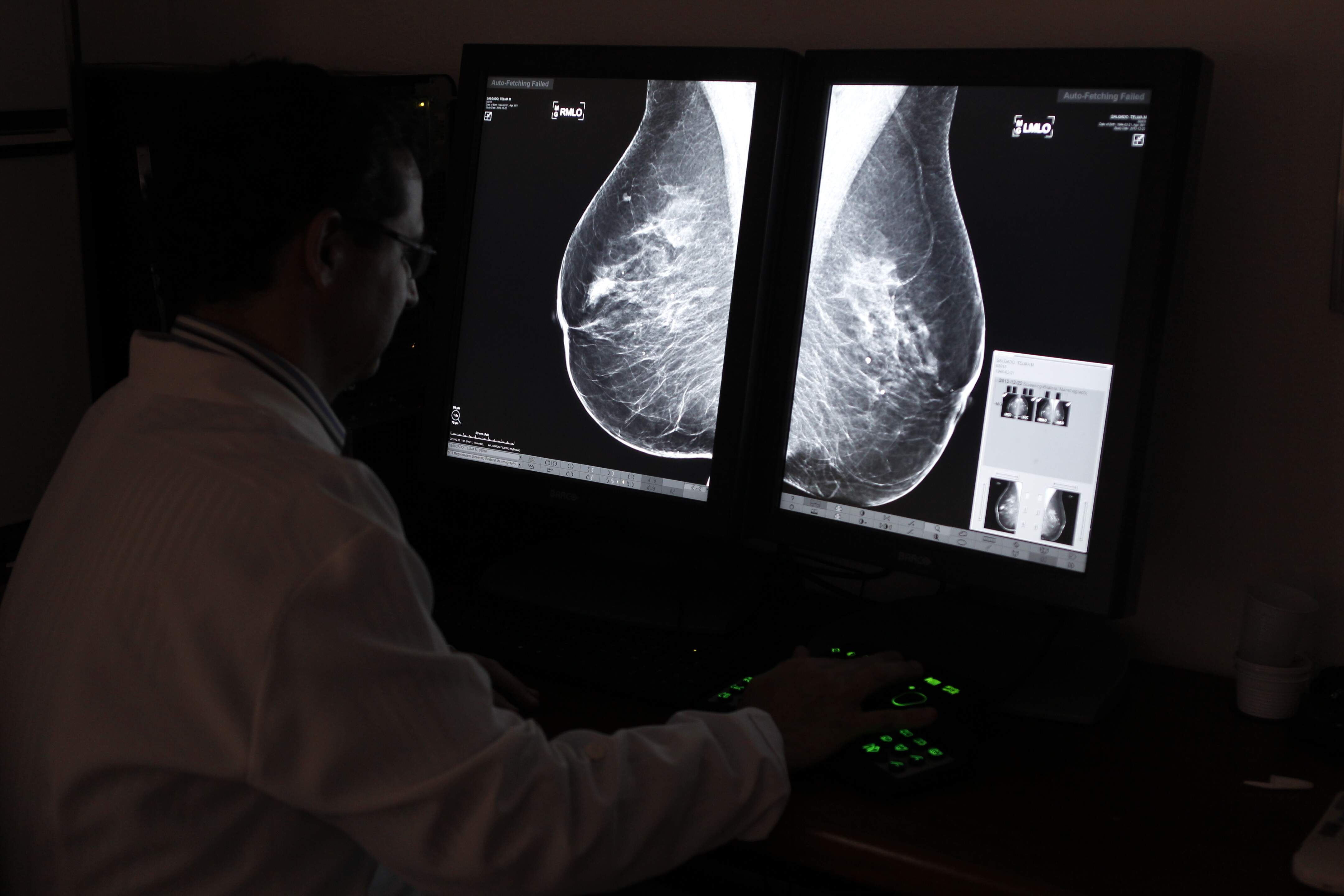 Há vários mutirões e campanhas de mamografia pelas cidades da região