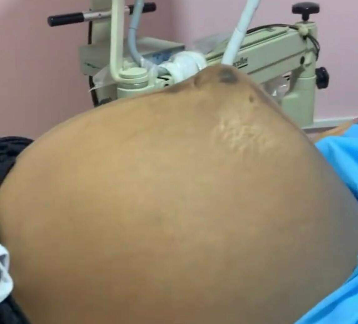Bebê mexeu e médica conseguiu ver nitidamente os movimentos 