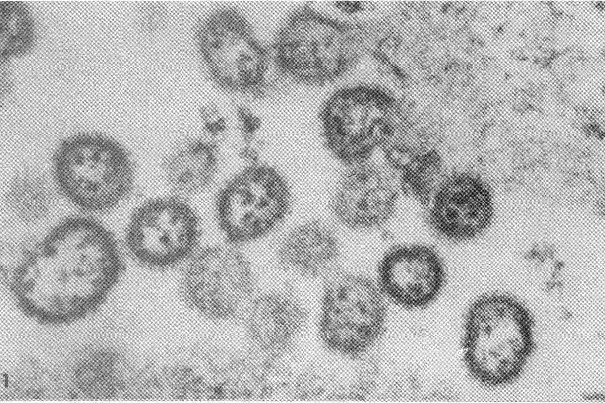 Apenas outros três casos do vírus (2 em SP e 1 no PA) foram registrados em toda a história