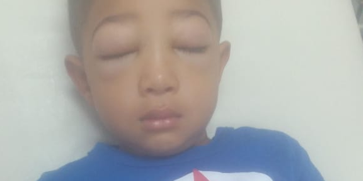 Criança de 4 anos com problema renal espera vaga em hospital de Praia Grande
