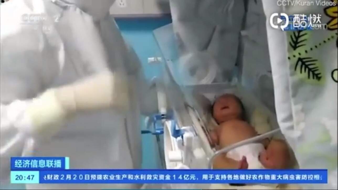 Menina é a mais jovem paciente a se recuperar do coronavírus na China