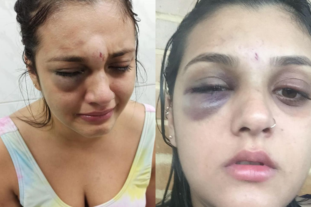 Jovem publicou fotos após ser agredida pelo namorado em São Vicente
