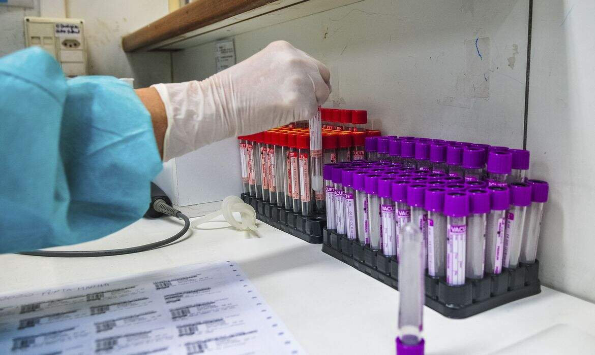 UFRJ desenvolve teste sorológico para coronavírus 20 vezes mais barato