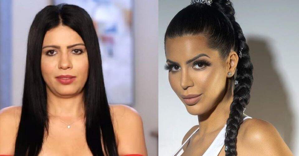 Larissa dos Santos Lima antes e depois das cirurgias 