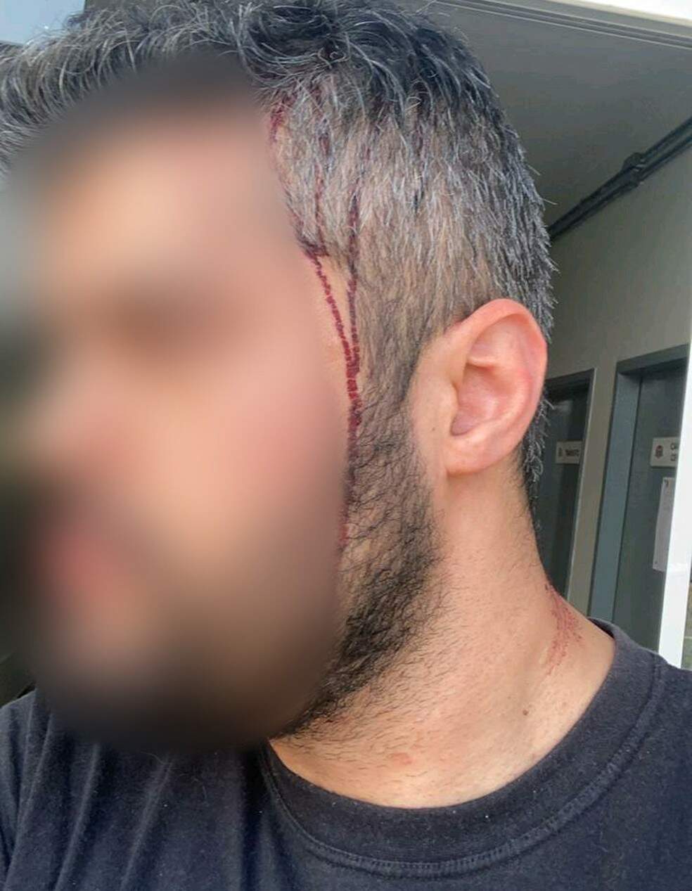 Homem foi agredido por ex-marido de atual namorada no interior paulista