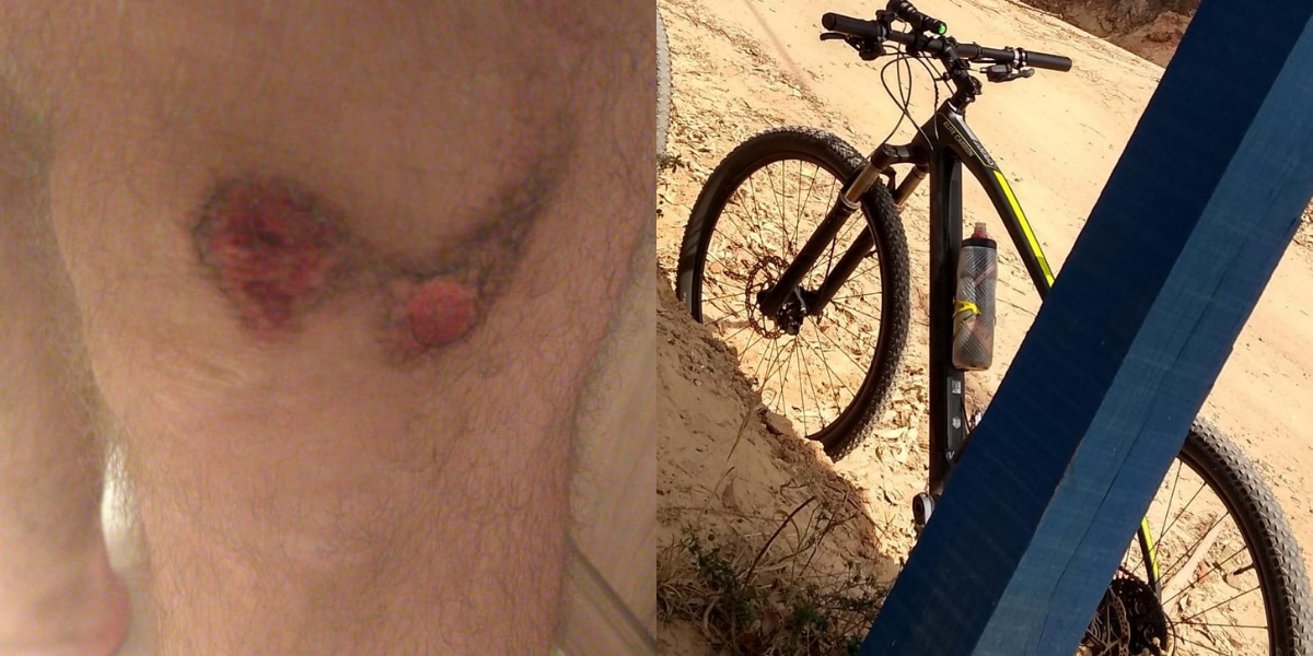 Ladrões atacam ciclista na Enseada  para roubar bicicleta de competição 