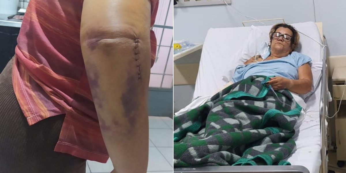 Selma dos Santos fraturou o cotovelo e precisar de fisioterapia para recuperar os movimentos