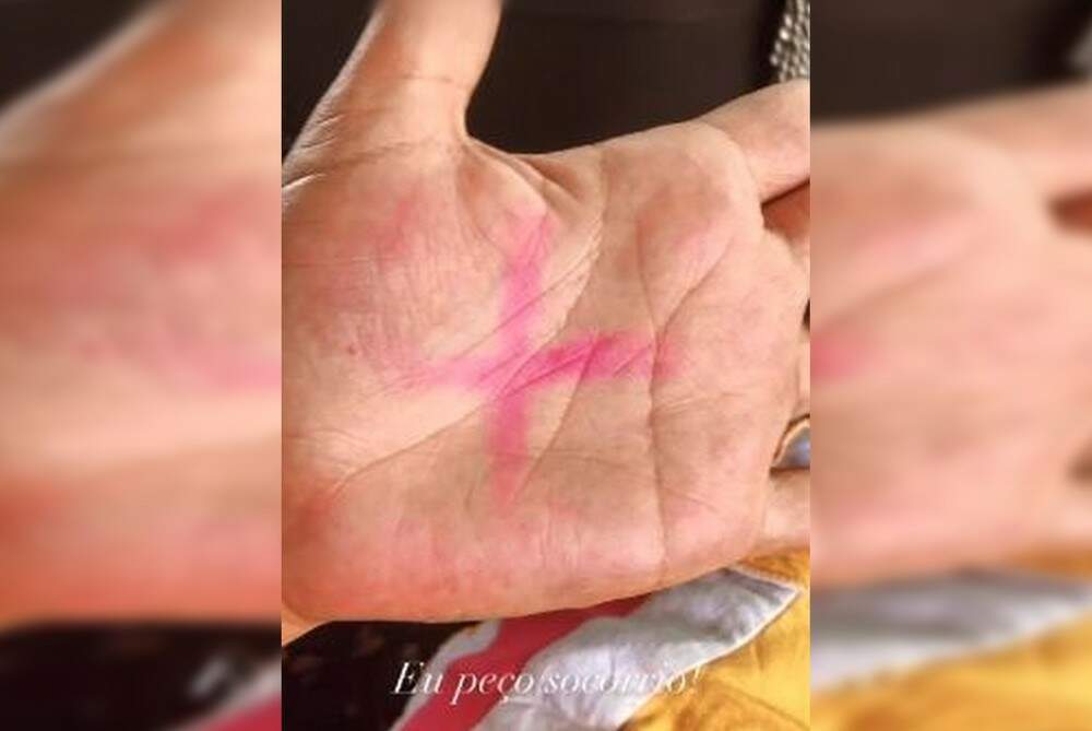 Mulher desenhou um 'X' nas mãos para pedir ajuda