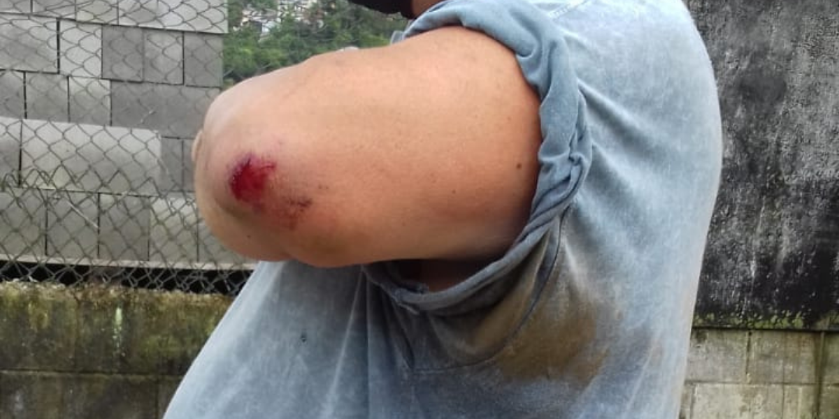 Marcelo caiu em um bueiro da Avenida Santista, em Santos( Foto: Divulgação/Viver no Morro e Região)